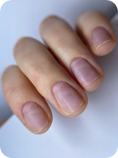 Natural nail buffed after BIAB removal